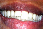 Ba 9