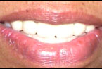Csp 2