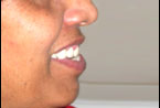 Csp 4